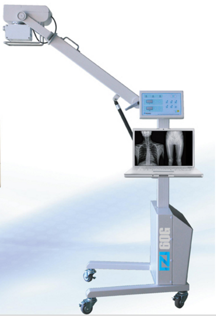 General IZI Mobile X-ray Systems Made in Korea