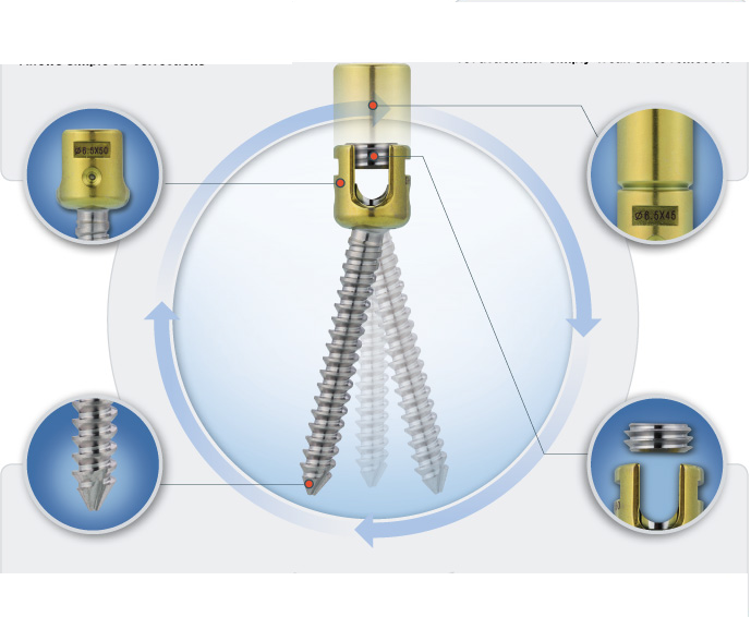 Tyche® Pedicle Screw System