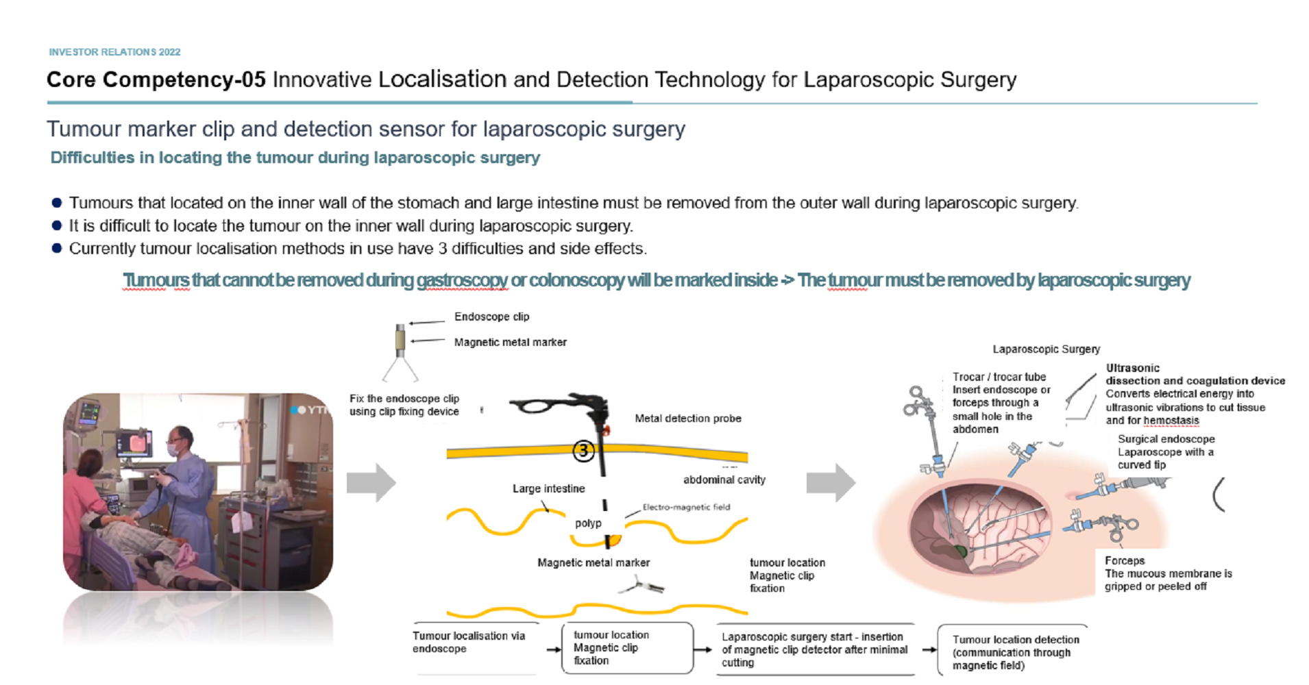 Innovative Localisation and Detection Technology for Laparoscopic Surgery
