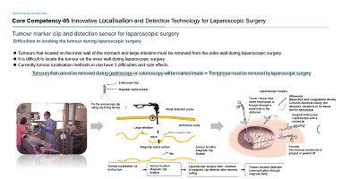 Innovative Localisation and Detection Technology for Laparoscopic Surgery  Made in Korea