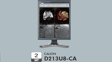 Diagnostics Display 21.3-inch 2MP Color
