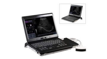 Mobile Ultrasound scanner Made in Korea